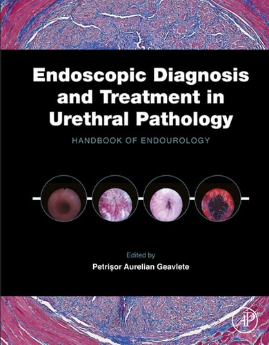Endoscopic Diagnosis and Treatment in Urethral Pathology: Handbook of Endourology cover