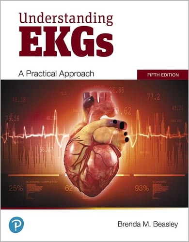 Understanding EKGs A Practical Approach cover