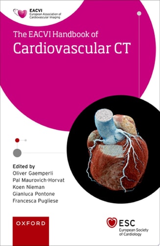 EACVI Handbook of Cardiovascular CT cover
