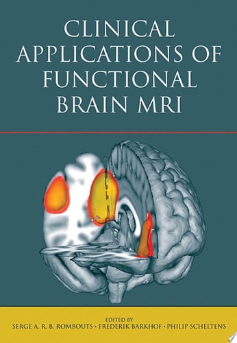 Clinical Applications of Functional Brain MRI cover