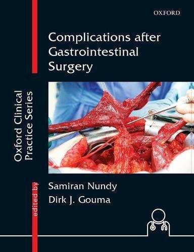 Complications After Gastrointestinal Surgery cover