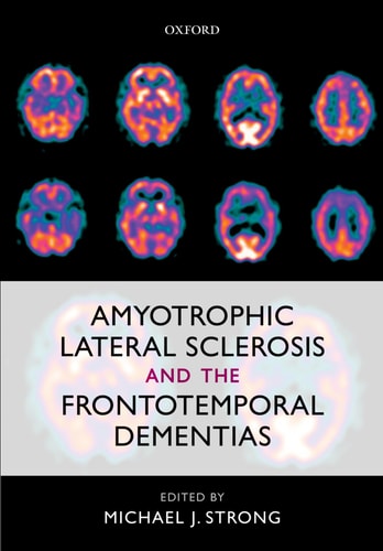 Amyotrophic Lateral Sclerosis and the Frontotemporal Dementias cover