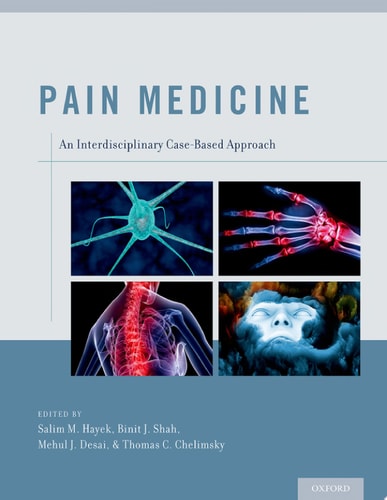Pain Medicine An Interdisciplinary Case-based Approach cover