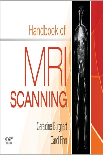 Handbook of MRI Scanning cover