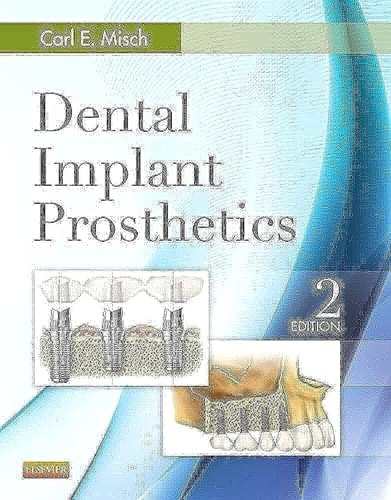 Dental Implant Prosthetics cover