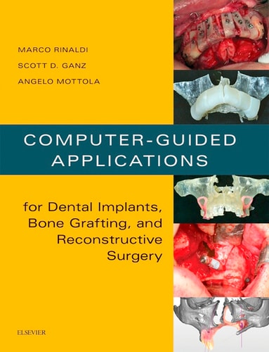 Computer-guided Applications for Dental Implants, Bone Grafting, and Reconstructive Surgery cover