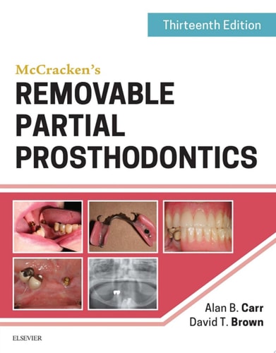 McCracken's Removable Partial Prosthodontics cover