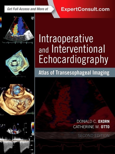 Intraoperative and Interventional Echocardiography Atlas of Transesophageal Imaging cover