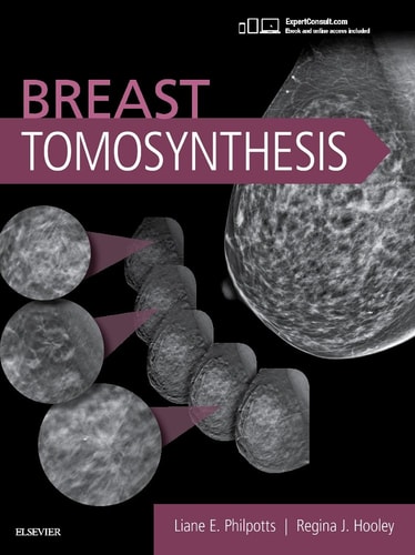 Breast Tomosynthesis cover