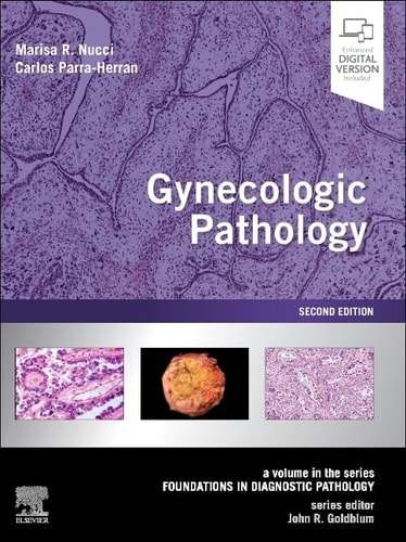 Gynecologic Pathology A Volume in Foundations in Diagnostic Pathology Series cover