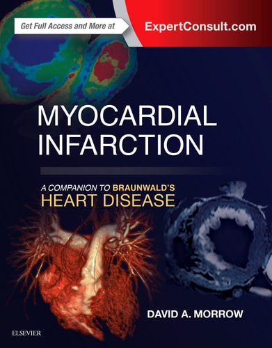 Myocardial Infarction A Companion to Braunwald's Heart Disease cover