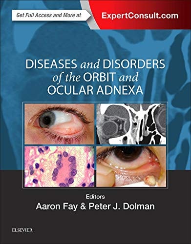 Diseases and Disorders of the Orbit and Ocular Adnexa cover