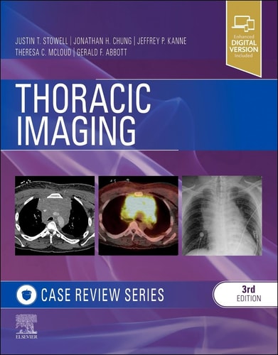 Thoracic Imaging: Case Review cover