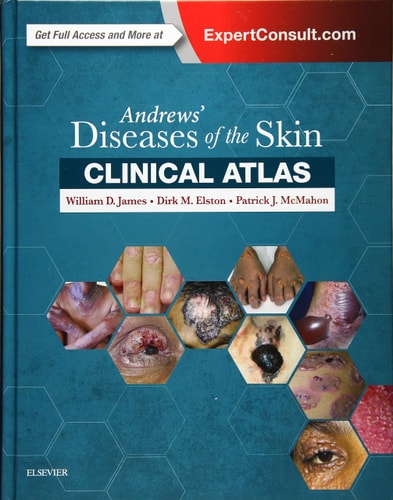 Andrews' Diseases of the Skin Clinical Atlas cover
