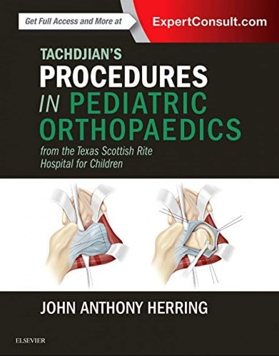 Tachdjian's Procedures in Pediatric Orthopaedics From the Texas Scottish Rite Hospital for Children cover