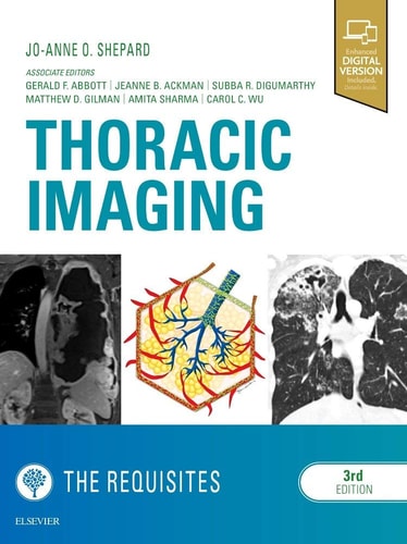 Thoracic Imaging the Requisites cover