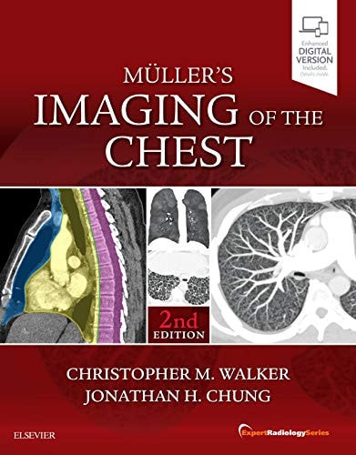 Muller's Imaging of the Chest Expert Radiology Series cover