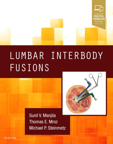 Lumbar Interbody Fusions cover