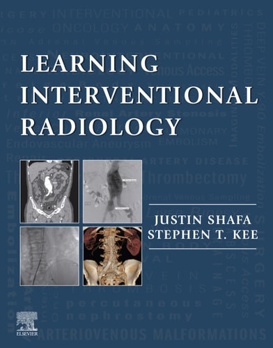 Learning Interventional Radiology cover