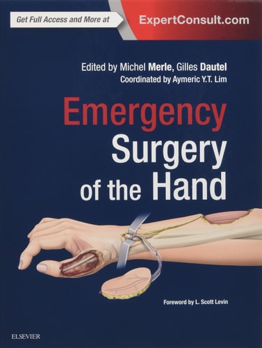 Emergency Surgery of the Hand cover