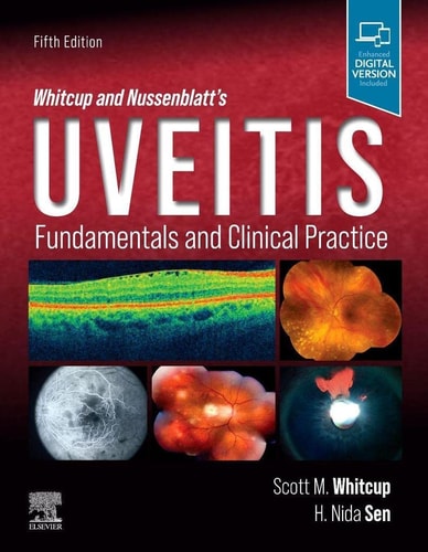Whitcup and Nussenblatt's Uveitis Fundamentals and Clinical Practice cover