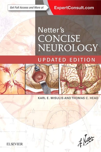 Netter's Concise Neurology cover