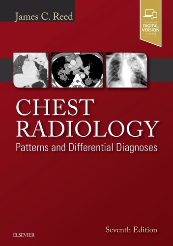 Chest Radiology Patterns and Differential Diagnoses cover