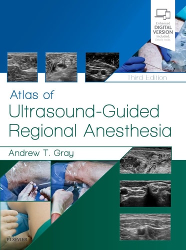 Atlas of Ultrasound-guided Regional Anesthesia cover