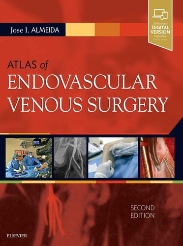 Atlas of Endovascular Venous Surgery cover