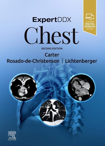 ExpertDDx: Chest cover