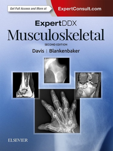 ExpertDDx: Musculoskeletal cover