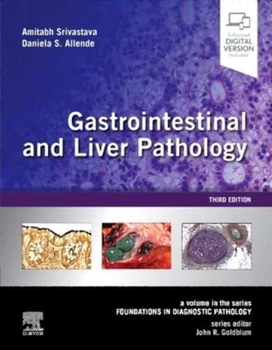 Gastrointestinal and Liver Pathology A Volume in the Series: Foundations in Diagnostic Pathology cover