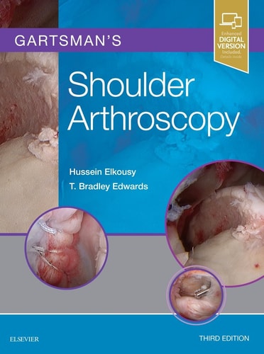 Gartsman's Shoulder Arthroscopy cover