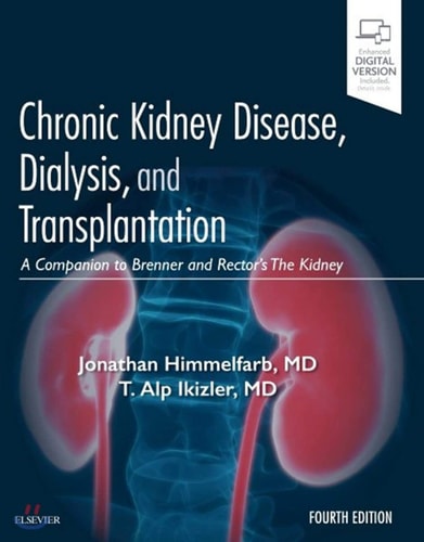 Chronic Kidney Disease, Dialysis, and Transplantation A Companion to Brenner and Rector's the Kidney cover