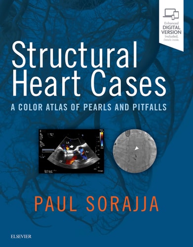 Structural Heart Cases A Color Atlas of Pearls and Pitfalls cover