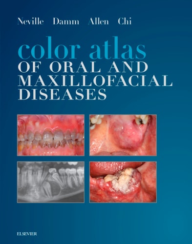 Color Atlas of Oral and Maxillofacial Diseases Elsevier eBook on VitalSource cover