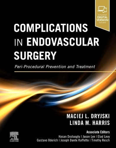 Complications in Endovascular Surgery Peri-Procedural Prevention and Treatment cover
