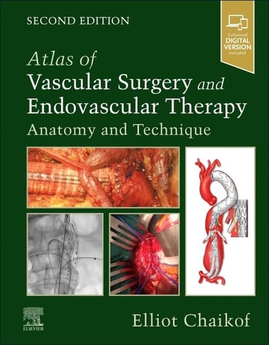 Atlas of Vascular Surgery and Endovascular Therapy Anatomy and Technique cover