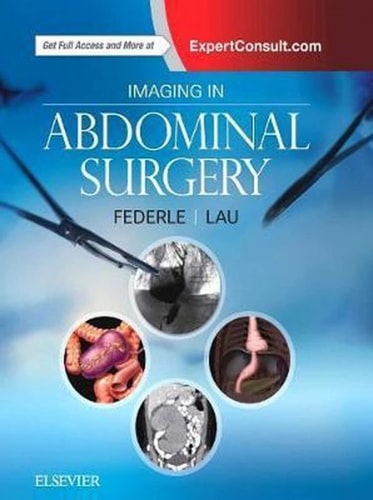 Imaging in Abdominal Surgery cover