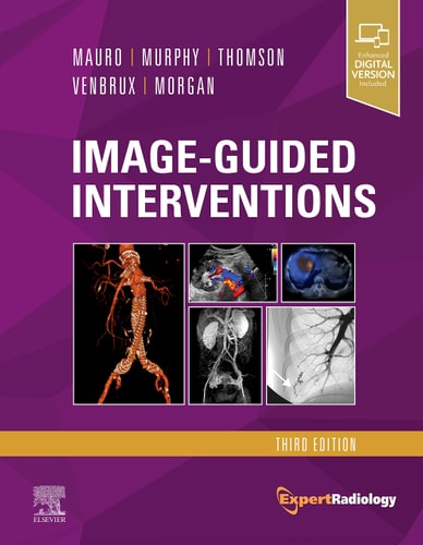 Image-Guided Interventions Expert Radiology Series cover