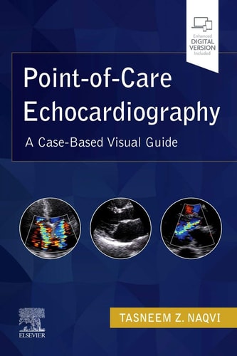 Point-Of-Care Echocardiography A Clinical Case-Based Visual Guide cover