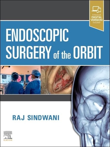 Endoscopic Surgery of the Orbit cover