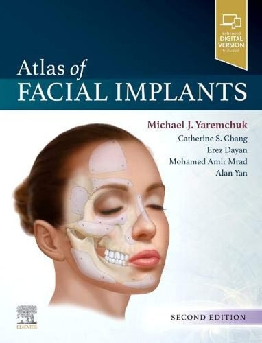 Atlas of Facial Implants cover