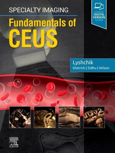 Specialty Imaging Fundamentals of CEUS cover