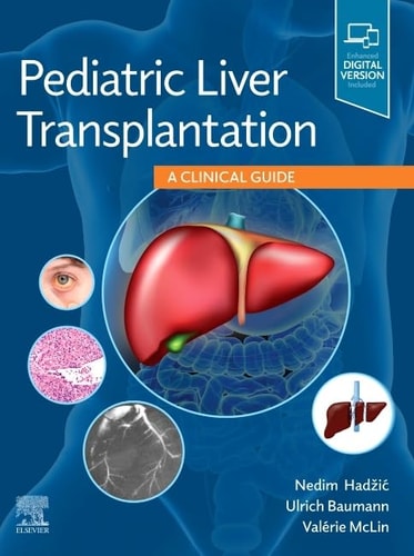 Pediatric Liver Transplantation A Clinical Guide cover