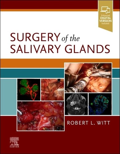 Surgery of the Salivary Glands cover