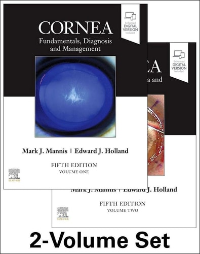 Cornea cover