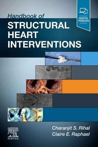 Handbook of Structural Heart Interventions cover