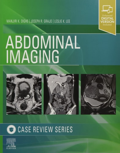 Abdominal Imaging Case Review Series cover