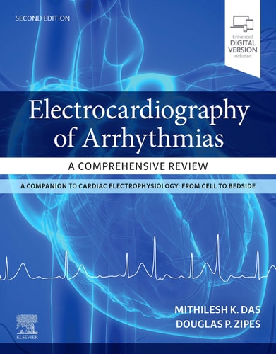 Electrocardiography of Arrhythmias A Comprehensive Review cover